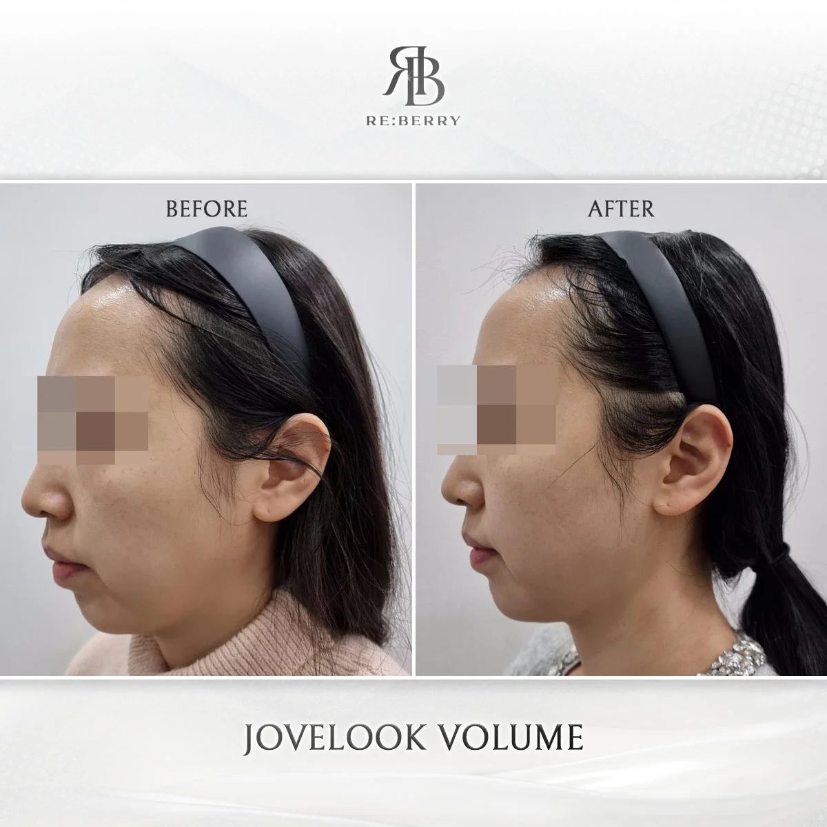 Juvelook Volume - Cheek